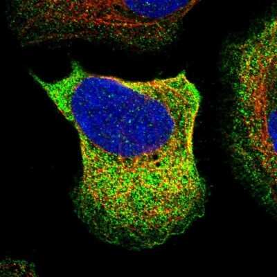 Immunocytochemistry/ Immunofluorescence: GARS Antibody [NBP1-85533]