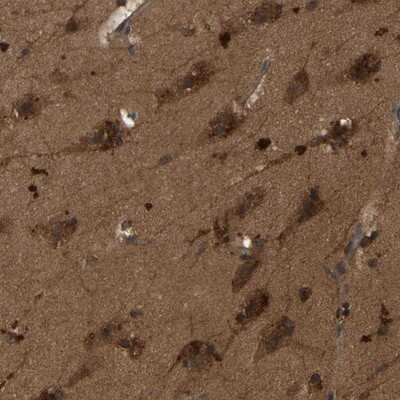Immunohistochemistry-Paraffin: GARS Antibody [NBP1-85533]