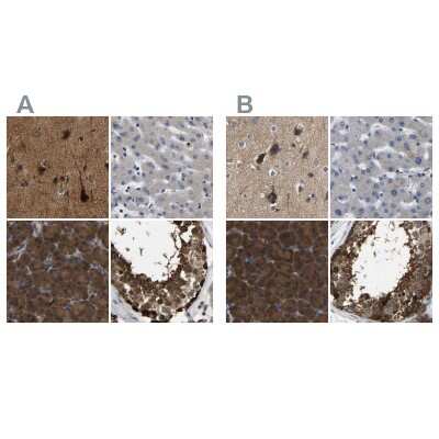 Immunohistochemistry-Paraffin: GARS Antibody [NBP1-85533]