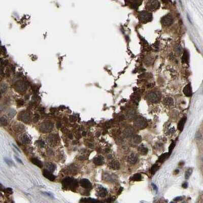 Immunohistochemistry-Paraffin: GARS Antibody [NBP1-85533]