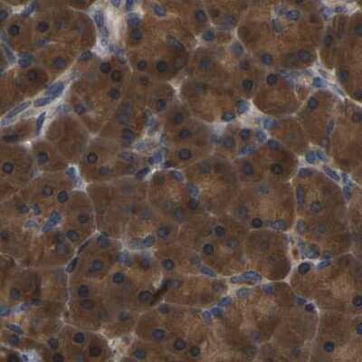 Immunohistochemistry-Paraffin: GARS Antibody [NBP1-85533]