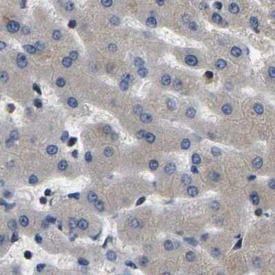 Immunohistochemistry-Paraffin: GARS Antibody [NBP1-85533]