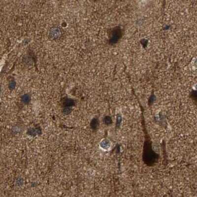 Immunohistochemistry-Paraffin: GARS Antibody [NBP1-85533]
