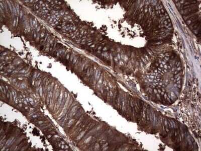 Immunohistochemistry: GARS Antibody (OTI4G4) - Azide and BSA Free [NBP2-70794]