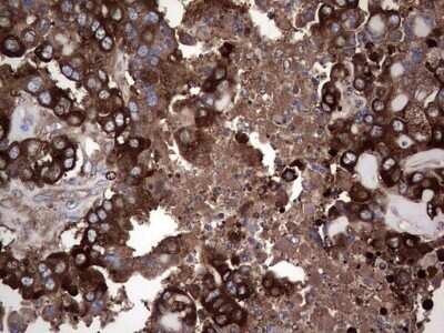 Immunohistochemistry: GARS Antibody (OTI4G4) - Azide and BSA Free [NBP2-70794]