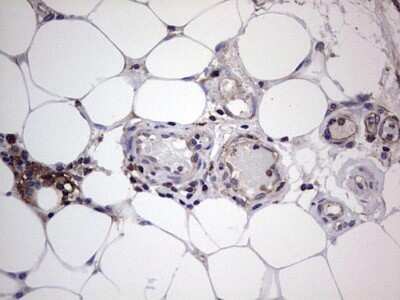 Immunohistochemistry: GARS Antibody (OTI4G4) - Azide and BSA Free [NBP2-70794]