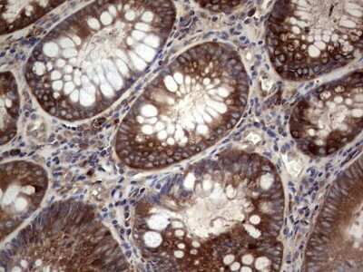 Immunohistochemistry: GARS Antibody (OTI4G4) - Azide and BSA Free [NBP2-70794]