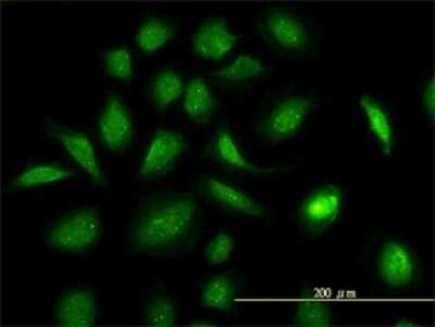 Immunocytochemistry/ Immunofluorescence: GART Antibody (4D6-1D5) [H00002618-M01]