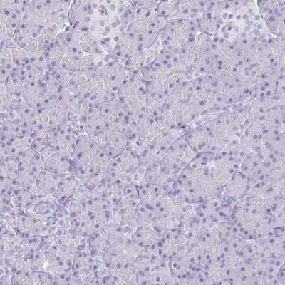 Immunohistochemistry-Paraffin: GAS2 Antibody [NBP2-31733]