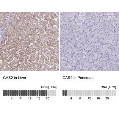 Immunohistochemistry-Paraffin: GAS2 Antibody [NBP2-31733]