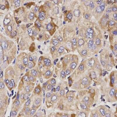 Immunohistochemistry-Paraffin: GAS2 Antibody - BSA Free [NBP3-04395]