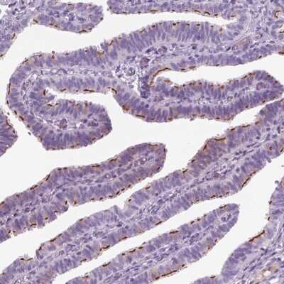 Immunohistochemistry-Paraffin: GAS2L2 Antibody [NBP2-32029]
