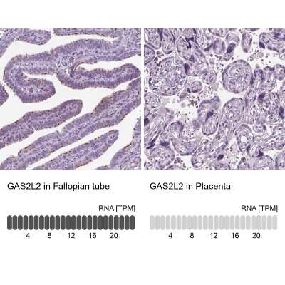 Immunohistochemistry-Paraffin: GAS2L2 Antibody [NBP2-32029]