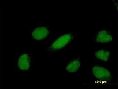Immunocytochemistry/ Immunofluorescence: GAS41 Antibody [H00008089-B01P]