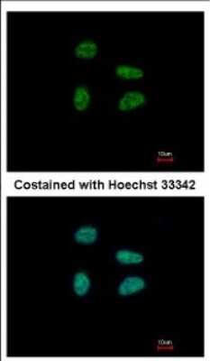 Immunocytochemistry/ Immunofluorescence: GAS41 Antibody [NBP2-16609]