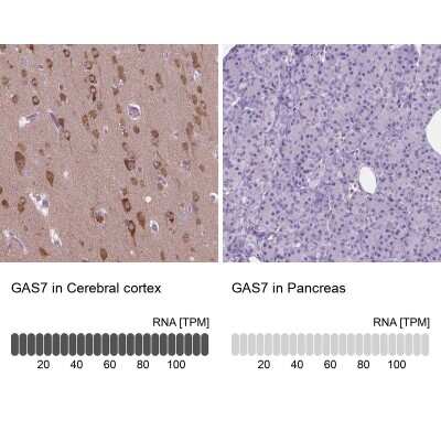Immunohistochemistry-Paraffin: GAS7 Antibody [NBP2-48498]