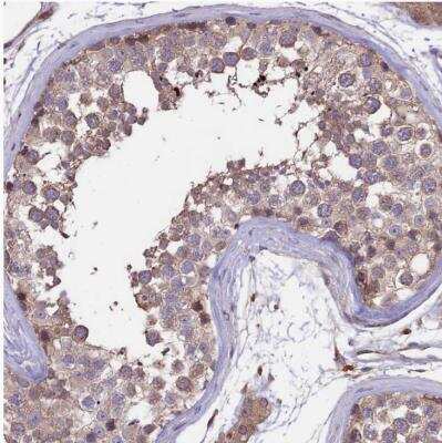 Immunohistochemistry-Paraffin: GAS8 Antibody [NBP2-14037]