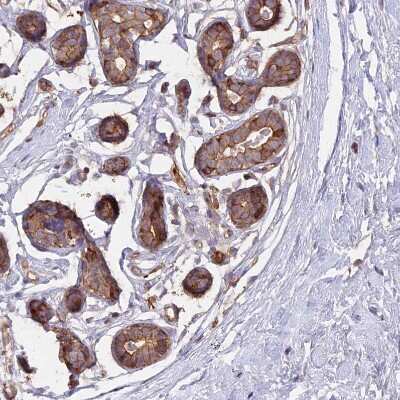 Immunohistochemistry-Paraffin: GAS8 Antibody [NBP2-14037]