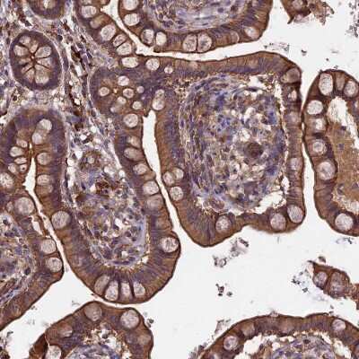 Immunohistochemistry-Paraffin: GAS8 Antibody [NBP2-14037]