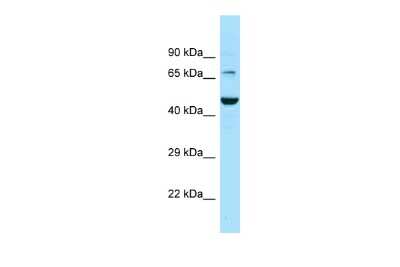 Western Blot: GAT3 Antibody [NBP2-84955]