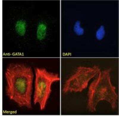 Immunocytochemistry/ Immunofluorescence: GATA-1 Antibody [NB100-2443]