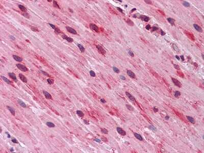 Immunohistochemistry-Paraffin: GATA-3 Antibody (7B5) - BSA Free [NBP1-47397]