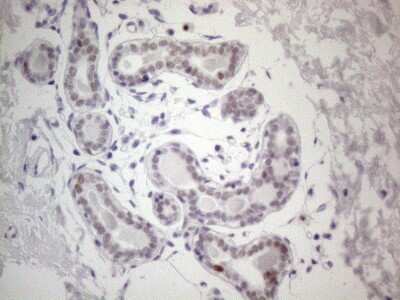 Immunohistochemistry: GATA-3 Antibody (OTI8H4) [NBP2-45810]