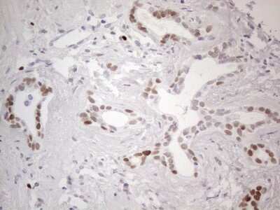 Immunohistochemistry: GATA-3 Antibody (OTI8H4) [NBP2-45810]
