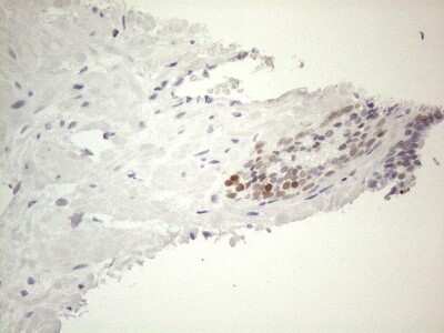 Immunohistochemistry: GATA-3 Antibody (OTI8H4) [NBP2-45810]
