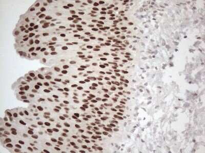 Immunohistochemistry: GATA-3 Antibody (OTI8H4) [NBP2-45810]