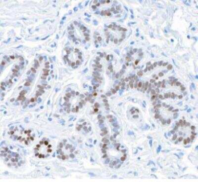 Immunohistochemistry-Paraffin: GATA-3 Antibody (BLR121H) [NBP3-14705]