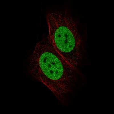 Immunocytochemistry/ Immunofluorescence: GATA-3 Antibody (CL8660) [NBP2-88917]