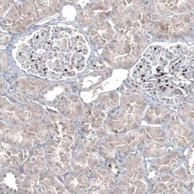 Immunohistochemistry-Paraffin: GATA-3 Antibody (CL8660) [NBP2-88917]