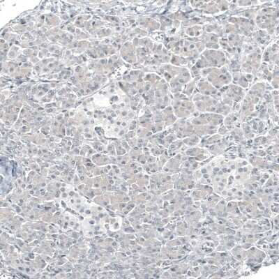 Immunohistochemistry-Paraffin: GATA-3 Antibody (CL8660) [NBP2-88917]