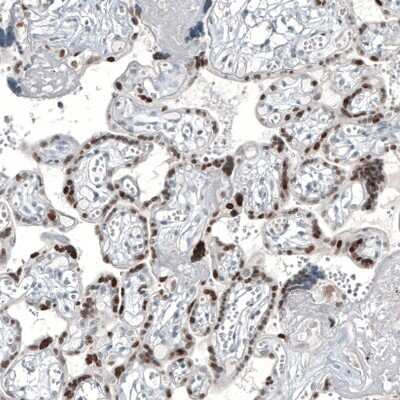 Immunohistochemistry-Paraffin: GATA-3 Antibody (CL8660) [NBP2-88917]