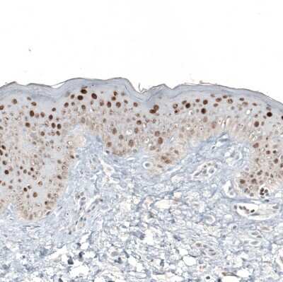 Immunohistochemistry-Paraffin: GATA-3 Antibody (CL8660) [NBP2-88917]