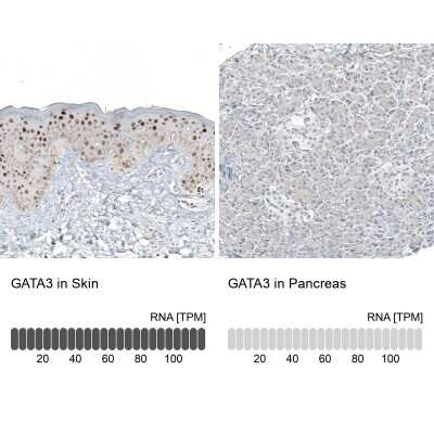 Immunohistochemistry-Paraffin: GATA-3 Antibody (CL8660) [NBP2-88917]
