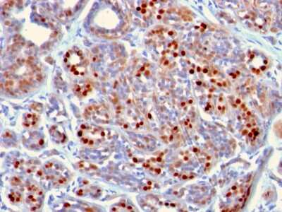 Immunohistochemistry-Paraffin: GATA-3 Antibody (GATA3/2442) [NBP3-07661]