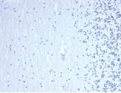 Immunohistochemistry-Paraffin: GATA-3 Antibody (GATA3/4550R) [NBP3-13922]