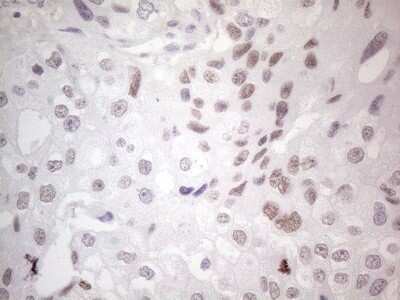 Immunohistochemistry: GATA-3 Antibody (OTI8H4) - Azide and BSA Free [NBP2-70796]