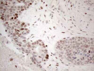 Immunohistochemistry: GATA-3 Antibody (OTI8H4) - Azide and BSA Free [NBP2-70796]