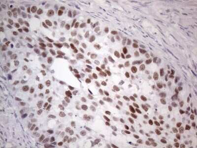 Immunohistochemistry: GATA-3 Antibody (OTI8H4) - Azide and BSA Free [NBP2-70796]