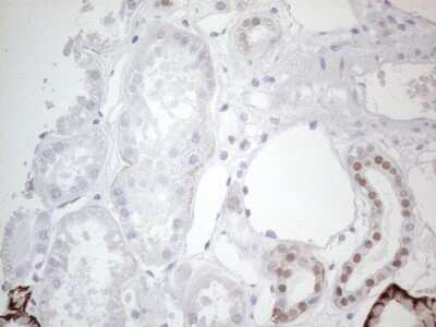 Immunohistochemistry: GATA-3 Antibody (OTI8H4) - Azide and BSA Free [NBP2-70796]