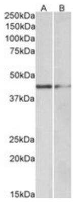 Western Blot: GATA-3 Antibody [NBP1-51912]
