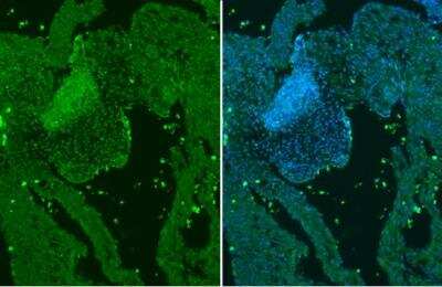 Immunohistochemistry-Paraffin: GATA-4 Antibody [NBP2-16613]