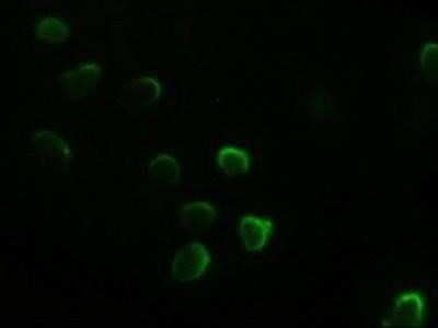 Immunocytochemistry/ Immunofluorescence: GATA-4 Antibody (OTI9F9) - Azide and BSA Free [NBP2-70797]