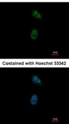 Immunocytochemistry/ Immunofluorescence: GATA-4 Antibody [NBP2-16613]