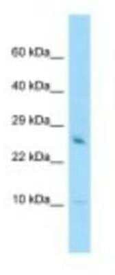 Western Blot: GATC Antibody [NBP1-98402]