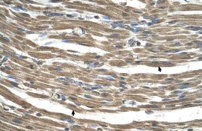 Immunohistochemistry-Paraffin: GATD3A Antibody [NBP1-80552]