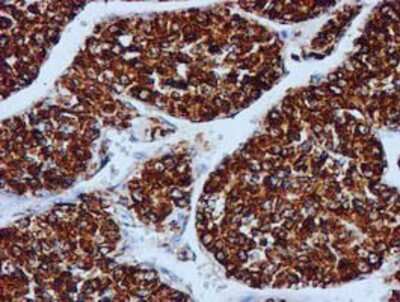 Immunohistochemistry-Paraffin: GATM Antibody (OTI1E3) [NBP2-00984]